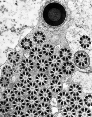 Octopus sperm