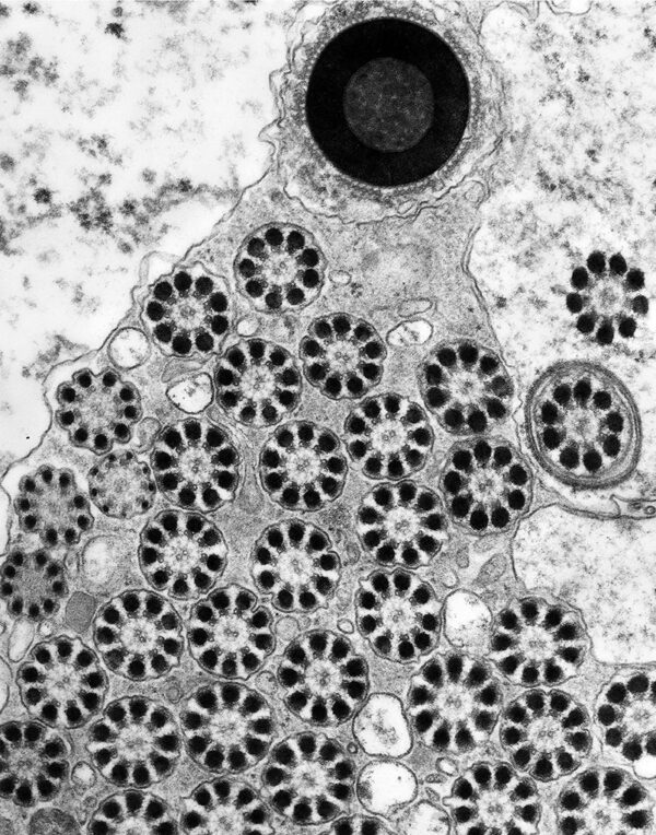 Octopus sperm