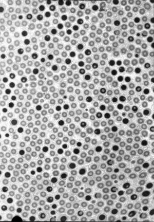 Worm sperm